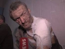 З полону терористів звільненили кіборга Шостака, якого допитував Lifenews