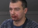Міліція почала розслідування нападу на журналістів Hromadske.tv поблизу Євромайдану