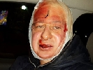 Бійці «Беркута» жорстоко побили фотографа «ЛІГАБізнесІнформ» (+ФОТО)