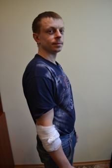 Спілка журналістів вимагає покарати винних у побитті черкаського журналіста Олега Огілька
