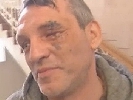 Фотограф, якому «Беркут» кинув в обличчя гранату, вважає це замахом на вбивство