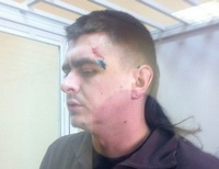 Затриманому і побитому «Беркутом» журналісту Ігорю Кобзарю надали медичну допомогу тільки через 11 годин