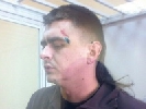 Затриманому і побитому «Беркутом» журналісту Ігорю Кобзарю надали медичну допомогу тільки через 11 годин