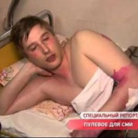 2 травня в Одесі постраждали щонайменше четверо журналістів