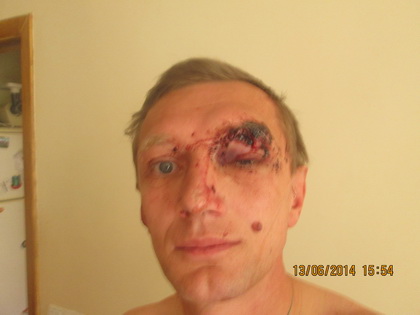 У Києві вже двічі жорстоко побили журналіста, що розслідує зловживання у пенітенціарній системі