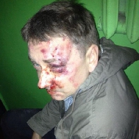 Правоохоронці завершують розслідування нападу на головного редактора сумської газети Євгена Положія