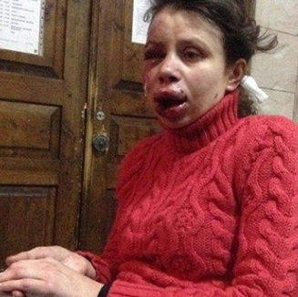 Підозрюваному у нападі на Тетяну Чорновол дали у Росії тимчасовий притулок