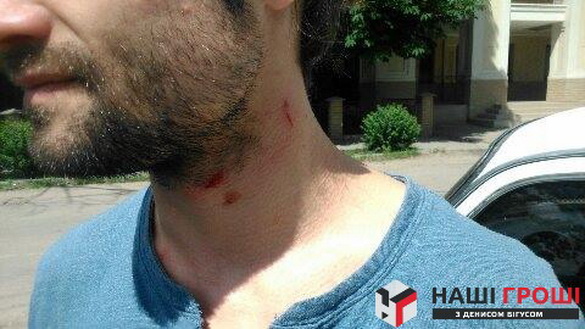 У Харкові стався напад на журналіста «Наших грошей» - відкрито провадження