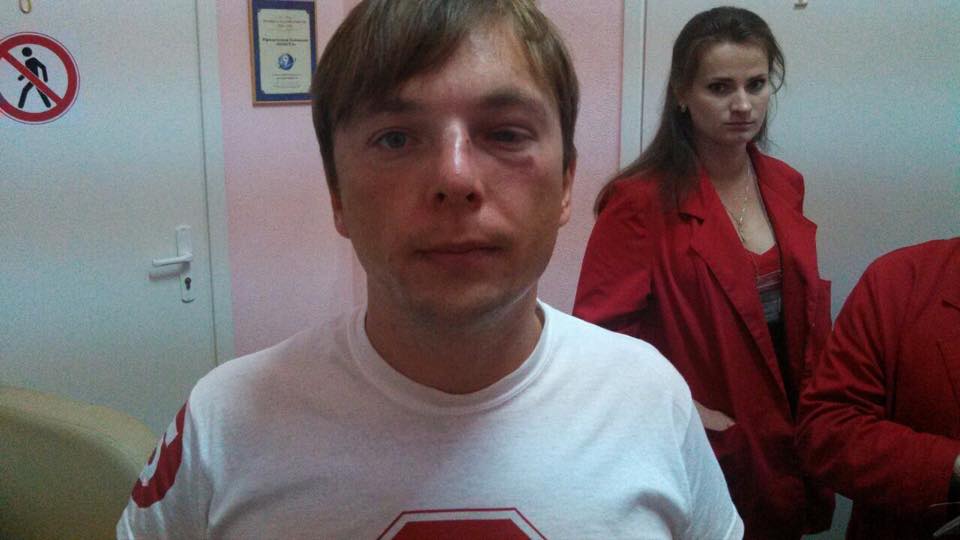 Журналіста «СтопКору» Медяника госпіталізовано через напад (ВІДЕО)