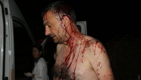 Жорстоко побитого журналіста Романа Варшанідзе з Одещини відвідав генсек Європейської федерації журналістів