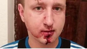В Одесі троє невідомих напали на журналіста ТРК «Репортер» Костянтина Гречаного - поліція