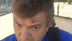 Поліція відкрила кримінальне провадження за фактом побиття журналіста Сергія Нікітенка у Херсоні