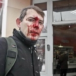 Побиті в донецькому супермаркеті журналісти оскаржать відмову порушити ст.171