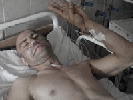 «Слово Волині» закликає допомогти пораненому в зоні АТО журналісту Богдану Пташнику