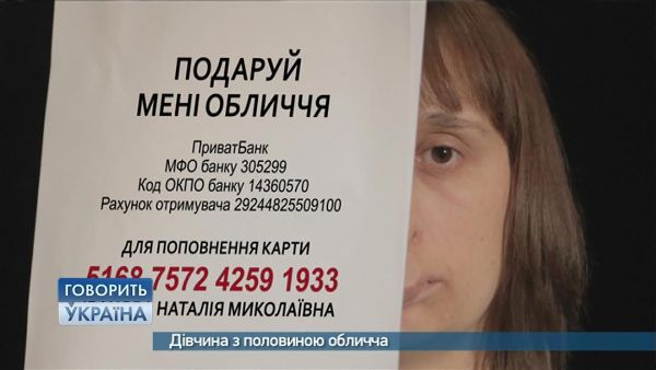 «Говорить Україна» пропонує взяти участь у флеш-мобі «Подаруй Наташі обличчя»