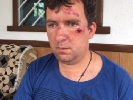 На Одещині невідомі напали на головного редактора «Вісника Комінтерново» (ДОПОВНЕНО)