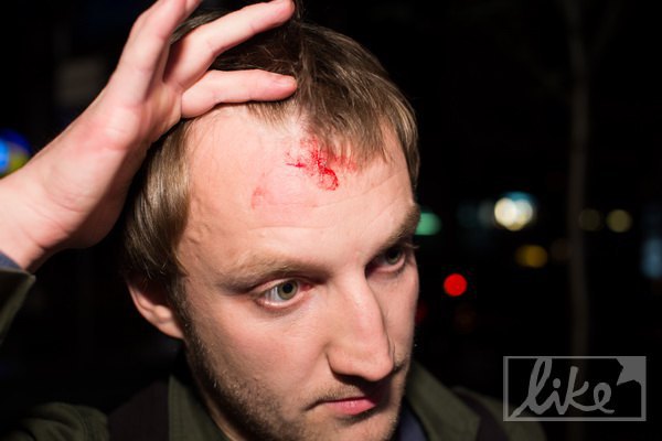 Охоронець Кіркорова кинув пляшку у фотографа LB.ua і розбив йому голову (ВІДЕО)