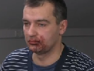 Міліція відкрила кримінальне провадження щодо нападу на журналістів Hromadske.tv