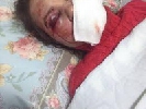 Микола Томенко вимагає від Генпрокуратури і МВС невідкладного розслідування побиття Тетяни Чорновол