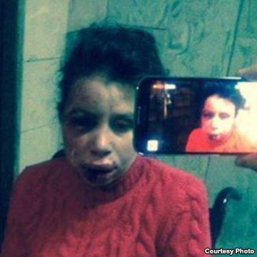 Посольство США засудило напад на журналістку Тетяну Чорновол