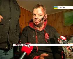 Кожара заявив Al Jazeera, що викрадення Булатова – «абсолютна неправда»