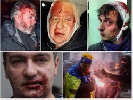 Під час висвітлення протестів в Україні постраждали 122 журналісти - &laquo;Детектор медіа&raquo;