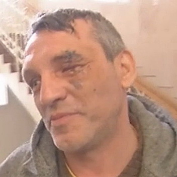 Фотограф, якому «Беркут» кинув в обличчя гранату, вважає це замахом на вбивство