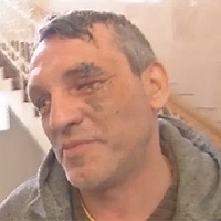 Розслідування щодо фотографа, якому «Беркут» кинув в обличчя  гранату, почали за повідомленням у ЗМІ