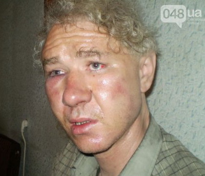 В Одеській області побили журналіста та спалили його квартиру за антипутінську позицію (ФОТО)
