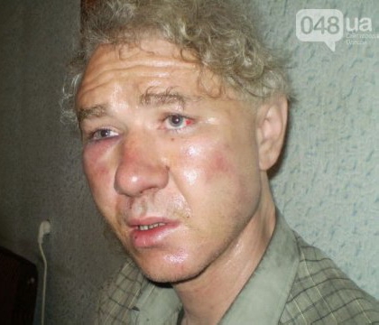 В Одеській області побили журналіста та спалили його квартиру за антипутінську позицію (ФОТО)