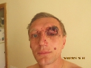 У Києві вже двічі жорстоко побили журналіста, що розслідує зловживання у пенітенціарній системі