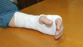 Головред газети «Нова Каховка» заявляє, що йому зламав руку помічник нардепа БПП