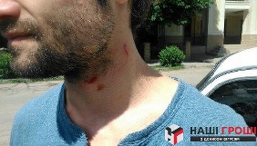 У Харкові стався напад на журналіста &laquo;Наших грошей&raquo; - відкрито провадження