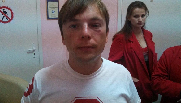 Журналіста «СтопКору» Медяника госпіталізовано через напад (ВІДЕО)