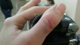 На Полтавщині під час концерту Козловського журналістці ТРК &laquo;Пирятин&raquo; забороняли зйомку та подряпали руку