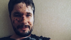 Крістофер Нанн планує видати книгу про Донбас та продовжить працювати в зоні АТО