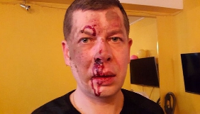Редактор &laquo;Бердичева ділового&raquo;, якого побили невідомі, називає напад актом залякування
