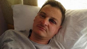 У Житомирі невідомі побили і пограбували відеооператора