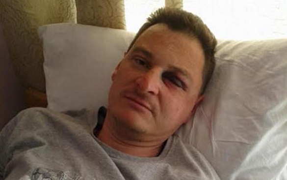 Житомирський журналіст скаржиться на слідство по справі про напад на нього