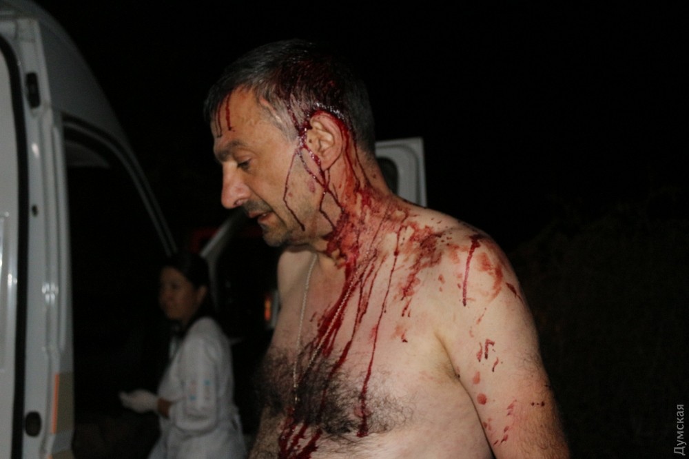 На Одещині жорстоко побили головреда газети «Надднестрянская правда» – нападники затримані