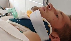 Пораненого оператора «Першого Криворізького» відключили від апарату штучної вентиляції легенів (ВІДЕО)