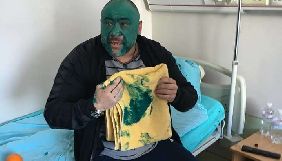Директор Інституту серця Борис Тодуров пояснив, чому Крисіна поклали в дитяче відділення