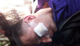 На території агропромислового підприємства Тернопільщини побили журналіста та оператора