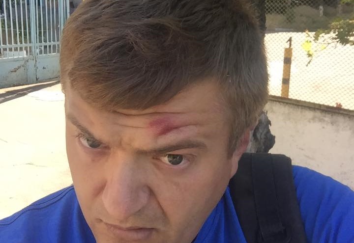 Сергій Нікітенко впізнав у своїх нападниках тих, від кого постраждав одеський журналіст Віталій Устименко