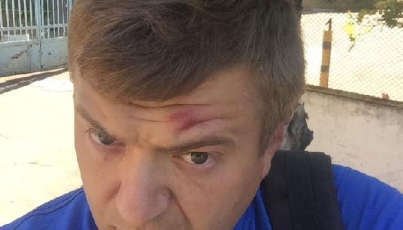 Сергій Нікітенко впізнав у своїх нападниках тих, від кого постраждав одеський журналіст Віталій Устименко