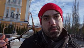 У Києві канадський журналіст постраждав від противників маршу пам'яті трансгендерних людей (ДОПОВНЕНО)