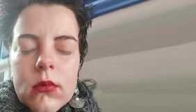 Журналістка журналу &laquo;Спільне&raquo; отримала опіки очей після нападу противників маршу пам&rsquo;яті трансгендерів