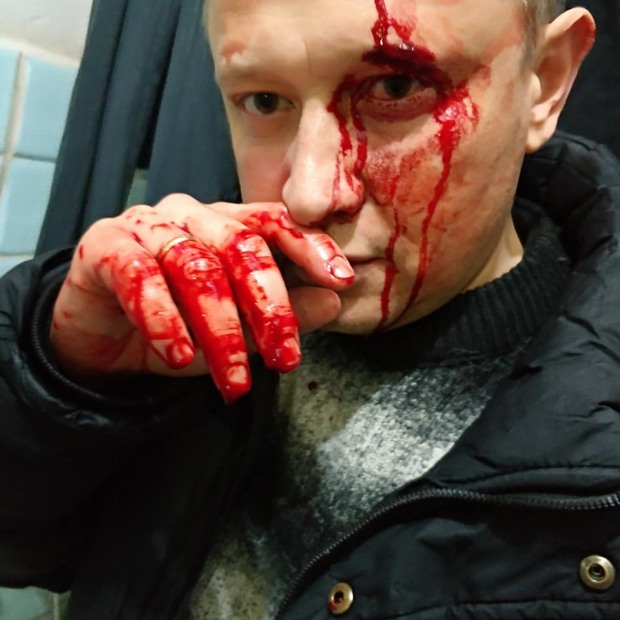У Дніпропетровській області невідомі побили журналіста  газети «Лица»