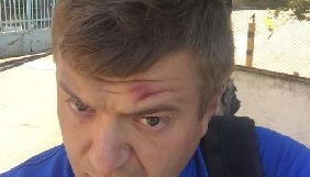 Підозрюваний в убивстві Гандзюк може бути причетний до нападу на херсонського журналіста &ndash; Масі Найєм