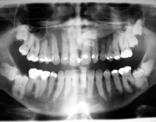 Проблема чутливості зубів